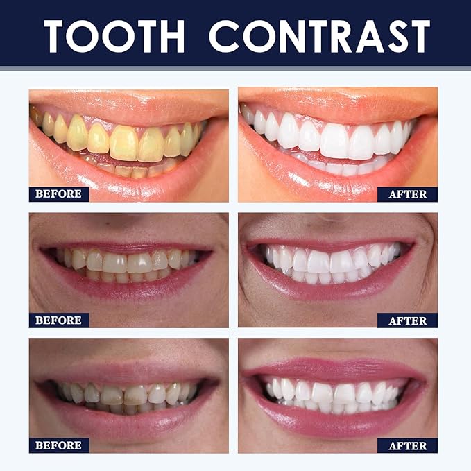 Teeth Whitening Powder - Probiotics Tooth Powder