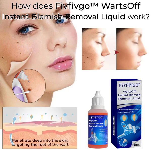 WartsOff Instant Blemish Removal Liquid
