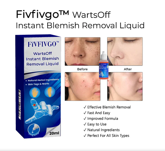 WartsOff Instant Blemish Removal Liquid