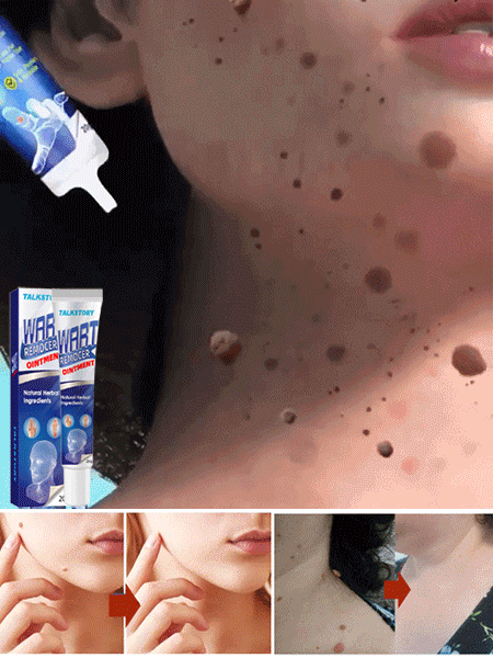 Wart Remover Gel