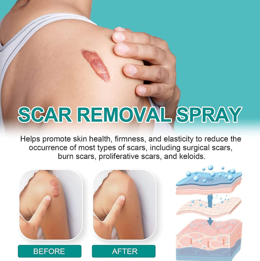 Advanced Scar Remove Spray
