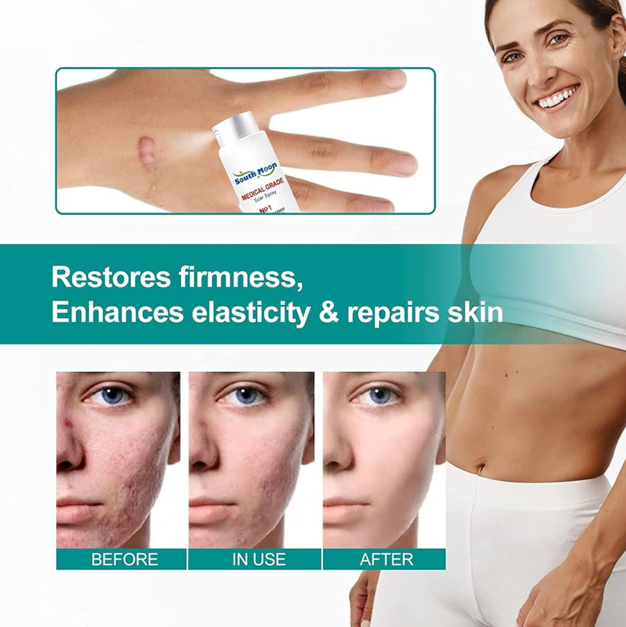 Advanced Scar Remove Spray