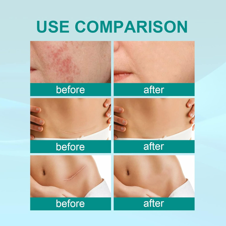 Advanced Scar Remove Spray