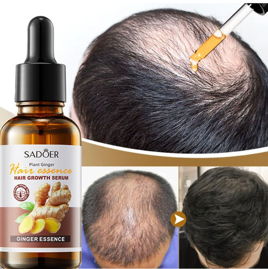 Plant Ginger Extract Hair Growth Serum