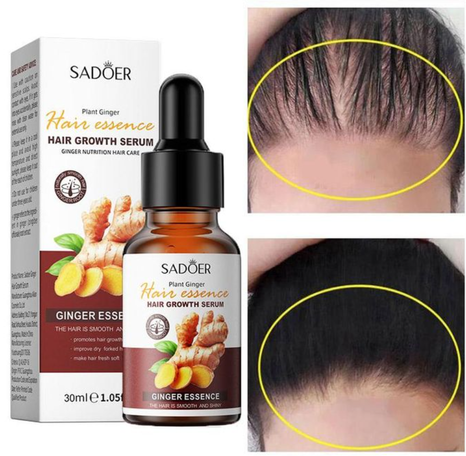 Plant Ginger Extract Hair Growth Serum