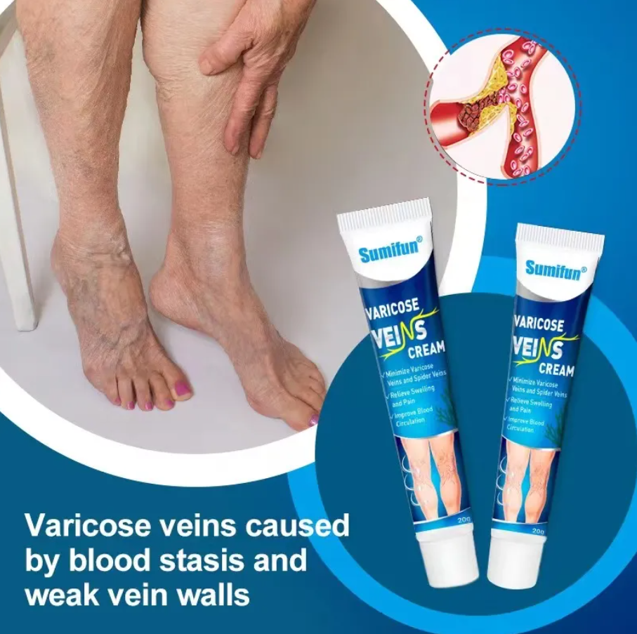 Varicose Veins Ointment - Buy 1 Get 1 Free