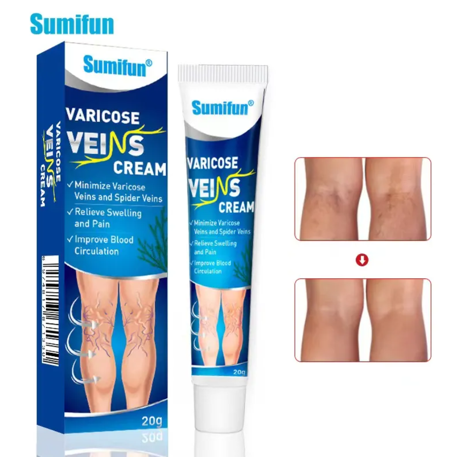 Varicose Veins Ointment - Buy 1 Get 1 Free
