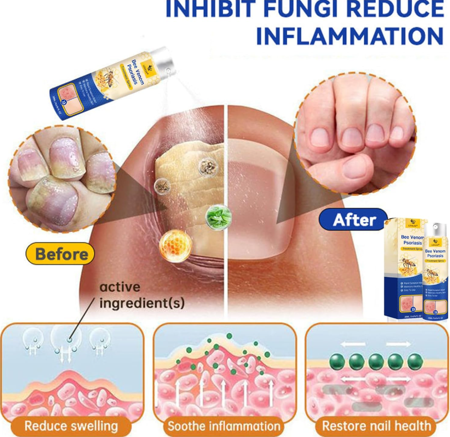 BeeVenom Psoriasis Care Spray Pro