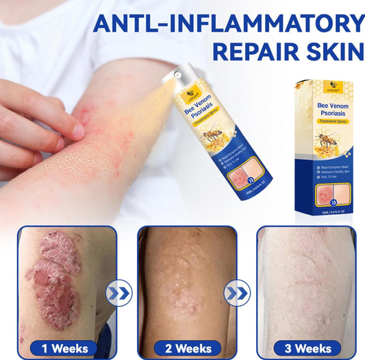 BeeVenom Psoriasis Care Spray Pro