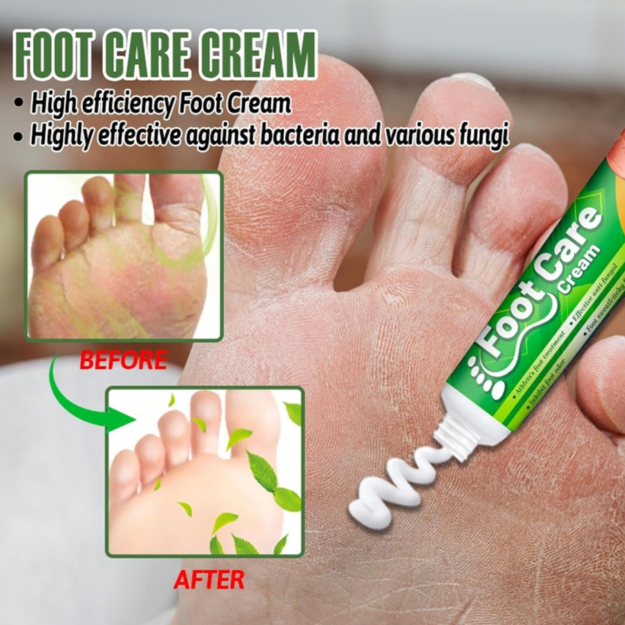 Herbal Foot Antifungal Cream 20g Relieves Foot Odor