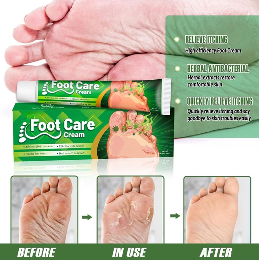 Herbal Foot Antifungal Cream 20g Relieves Foot Odor