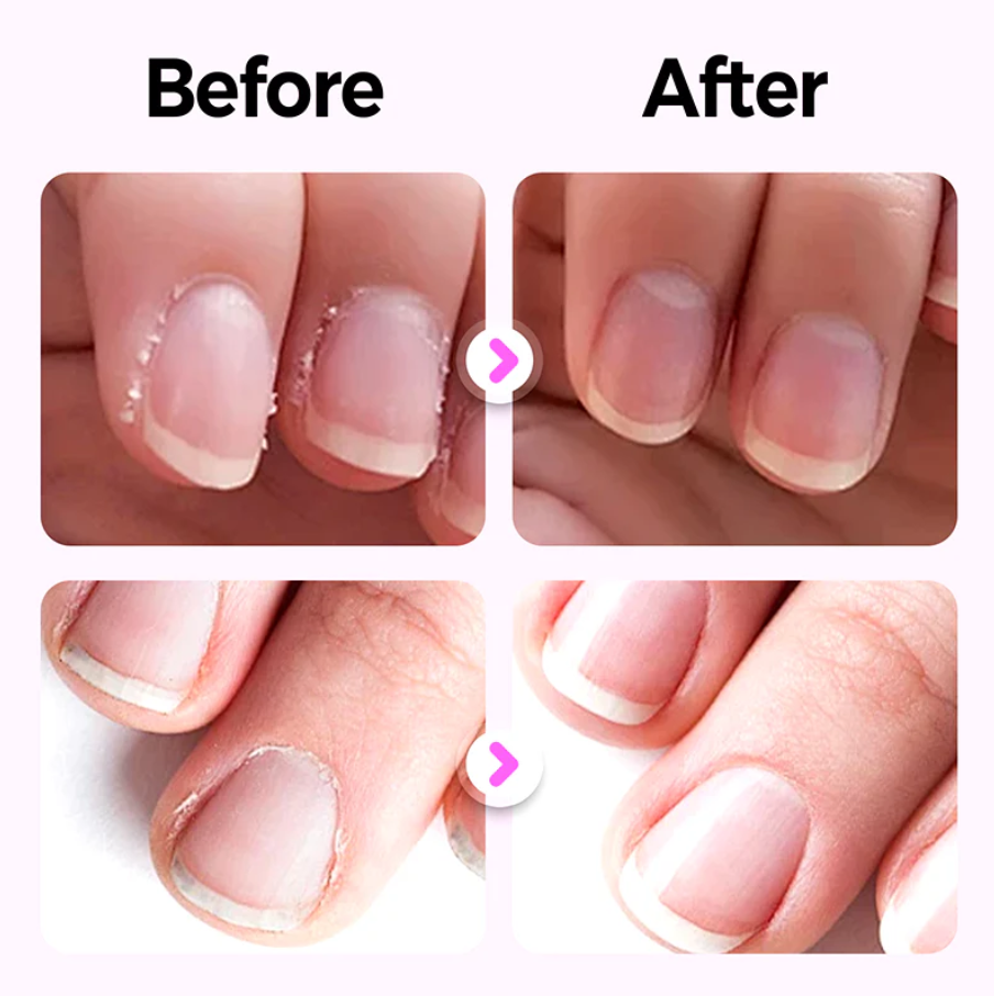 3-in-1 Nail Care Pen