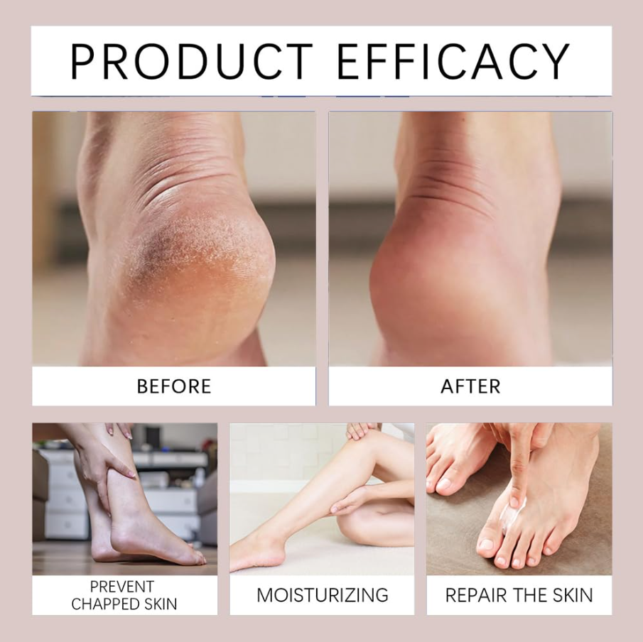 Diabetics Skin Relief cream