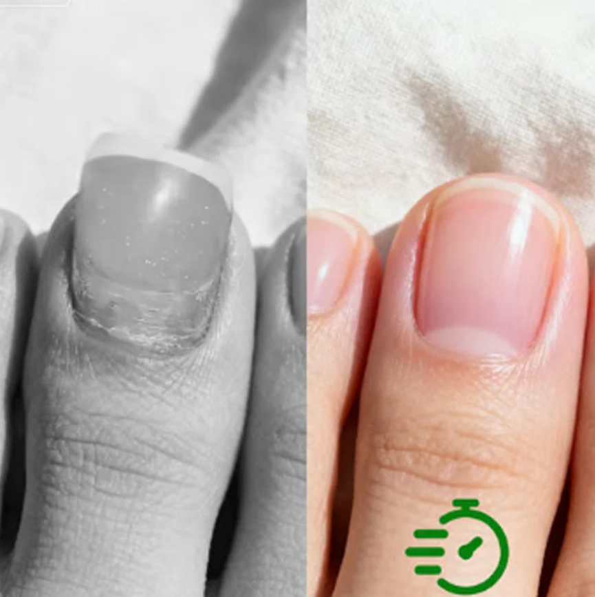 Nail Repair & Antifungal Solution