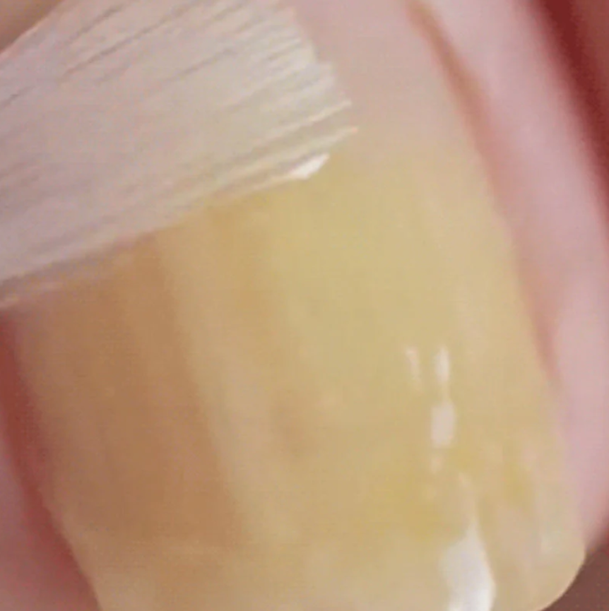 Nail Repair & Antifungal Solution