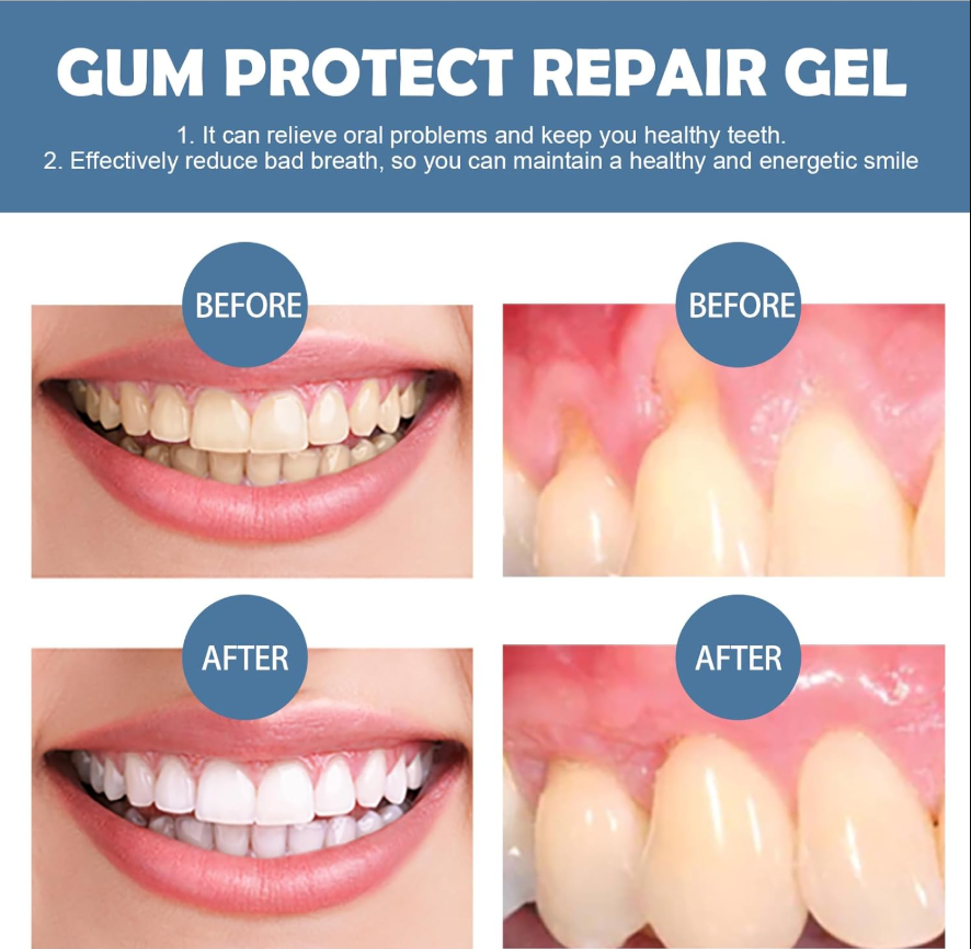 Gum Protect Dental Repair Gel
