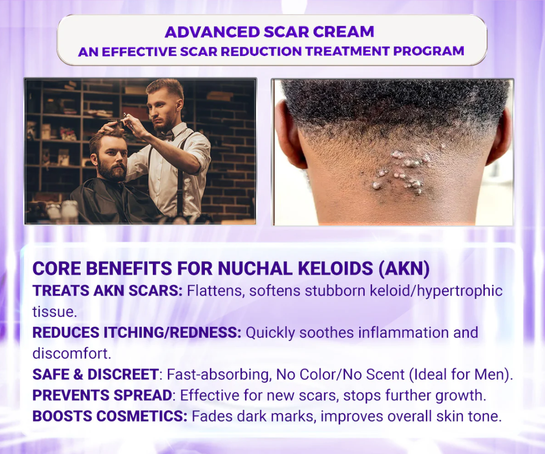 Kelo Scar Cream