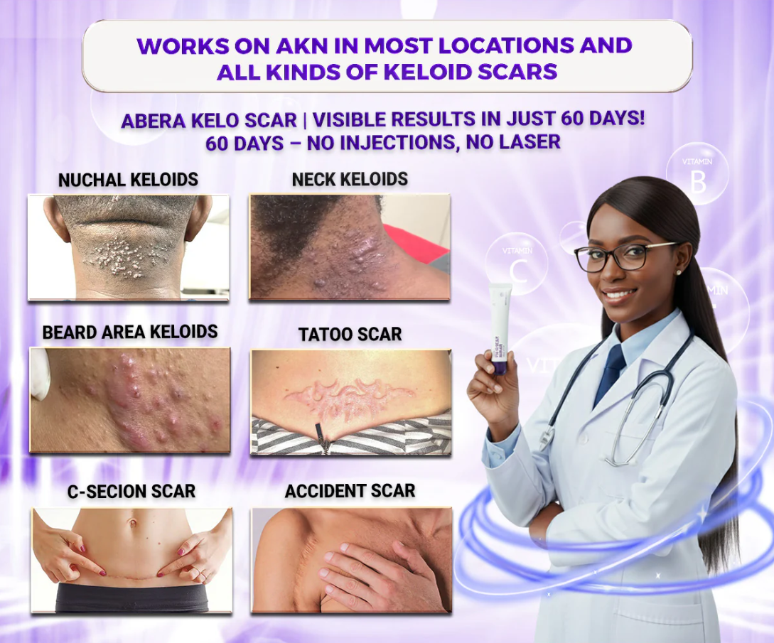 Kelo Scar Cream