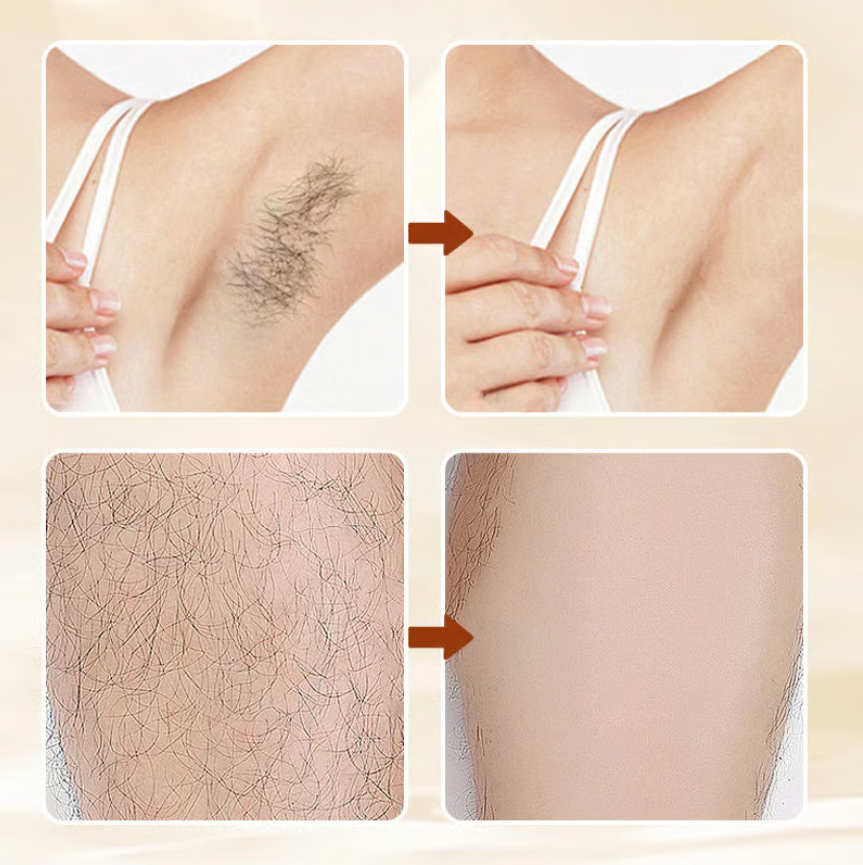 Mild Hair Removal Cream