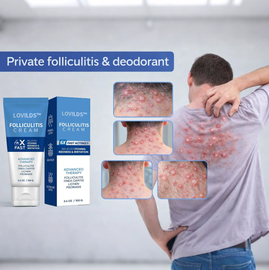 Folliculitis Cream