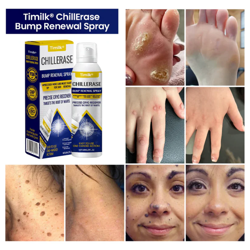 ChillErase Bump Renewal Spray