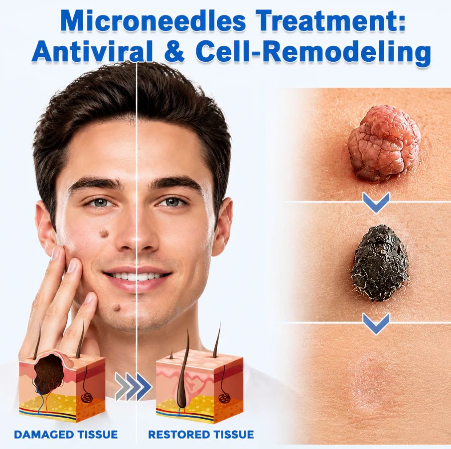 2-in-1 Microneedle & Hydrocolloid Patch