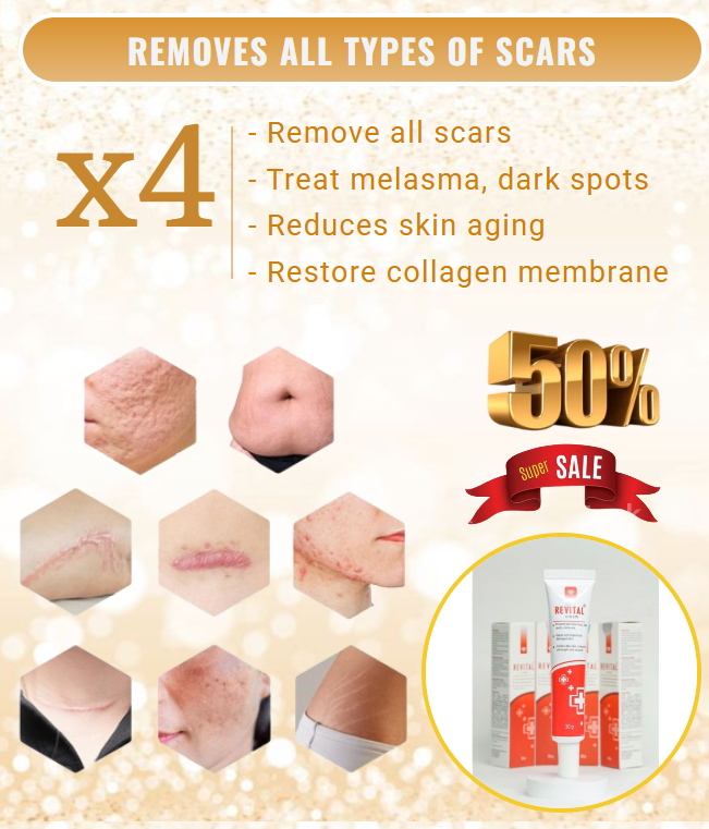 Revital Scar Treatment Cream