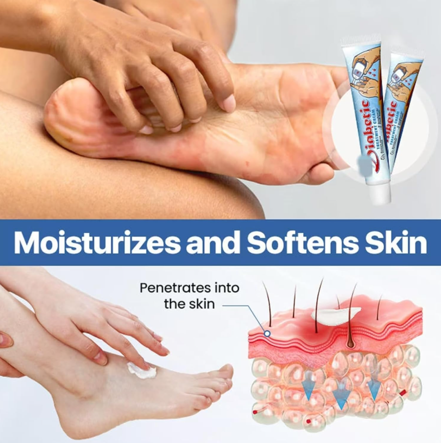 Diabetics Skin Relief cream