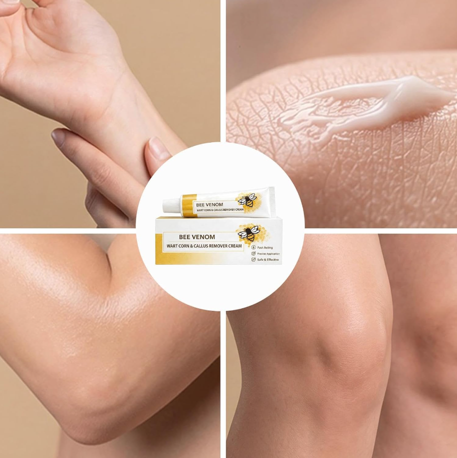 Bee Venom Corn & Callus Remover Cream