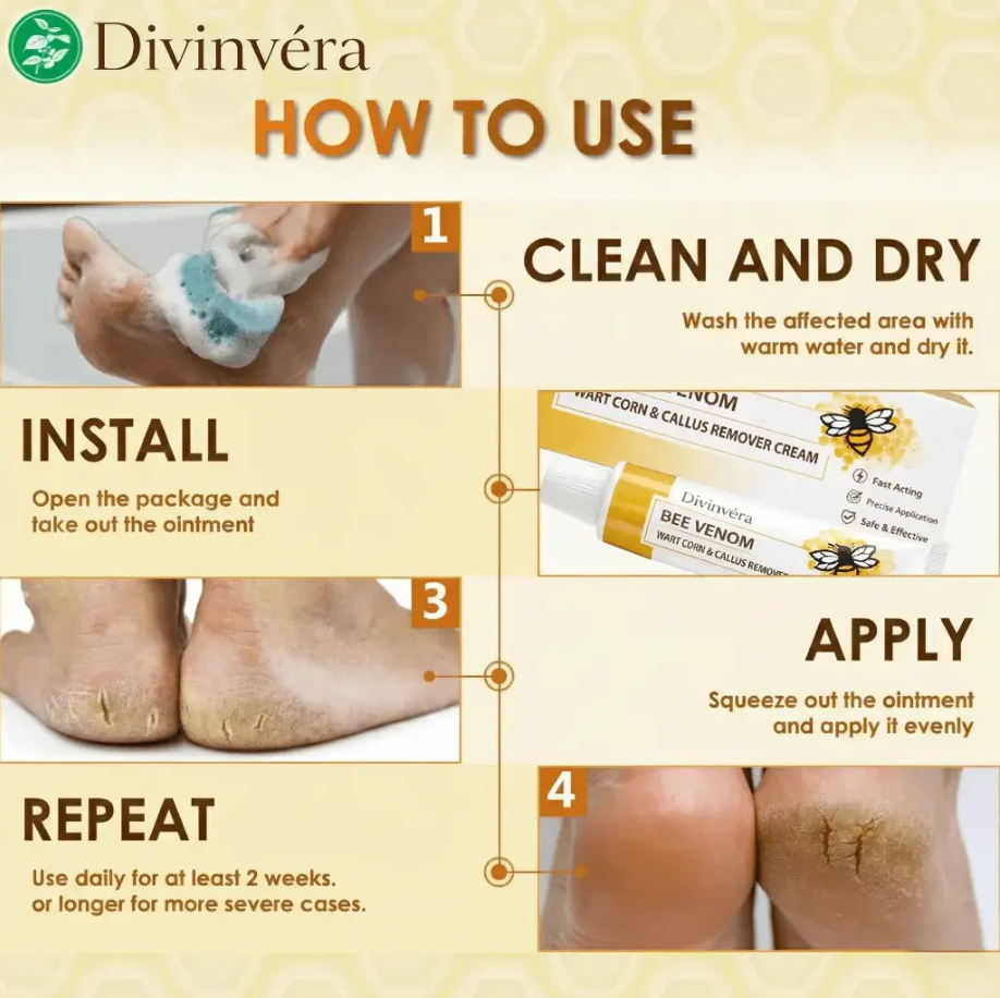 Bee Venom Corn & Callus Remover Cream