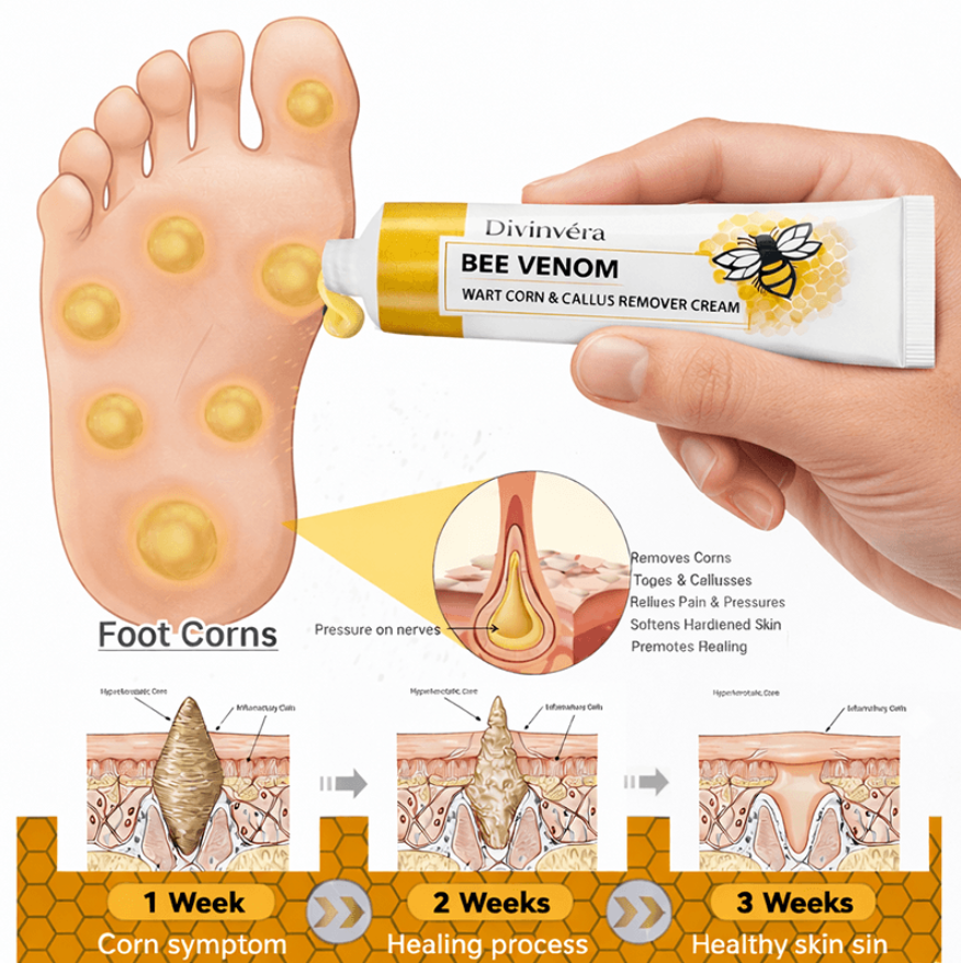 Bee Venom Corn & Callus Remover Cream